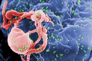 http://en.wikipedia.org/wiki/HIV#mediaviewer/File:HIV-budding-Color.jpg